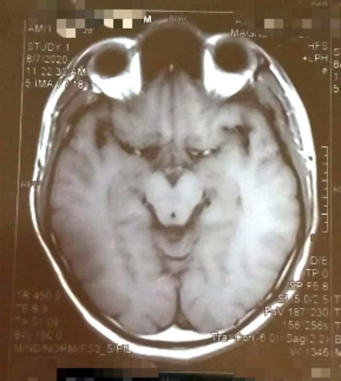 Bu tuhaf görünümlü yaratık aslında birinin beyni. Evet, bu bir MRI.