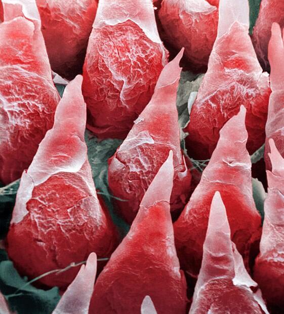 İnsan dilinin mikroskop altındaki görüntüsü